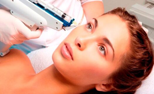 Inyecciones para rejuvenecer